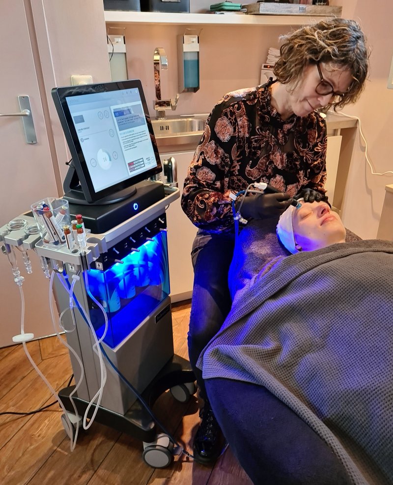 Hydrafacial dermabrasie behandeling Beauty Salon Florin Ede