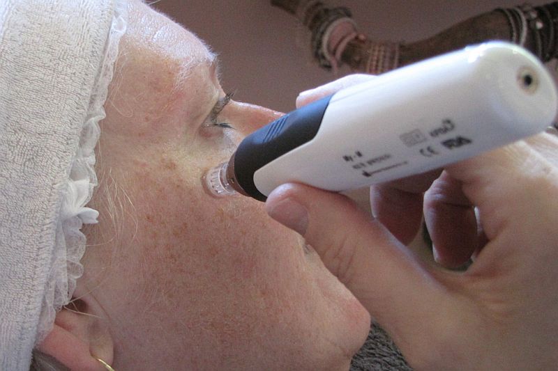 Micro needling bij Florin Beauty Salon in Ede